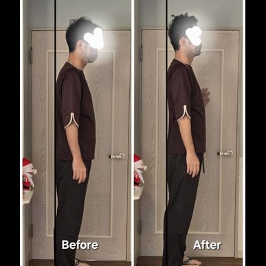 治療効果の検証📸姿勢のビフォーアフター（指圧治療院WillRich）