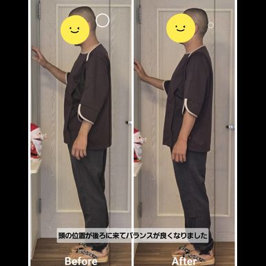 治療効果の検証📸姿勢のビフォーアフター　その２（指圧治療院WillRich） 
