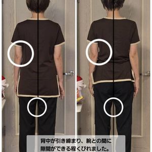治療効果の検証📸姿勢のビフォーアフター　その3（指圧治療院WillRich）
