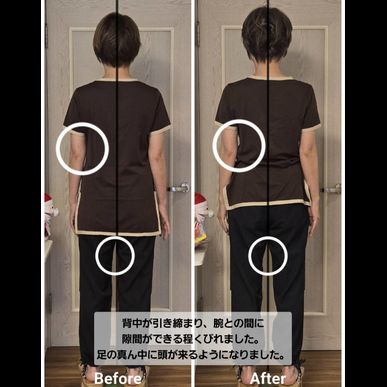 治療効果の検証📸姿勢のビフォーアフター　その3（指圧治療院WillRich）