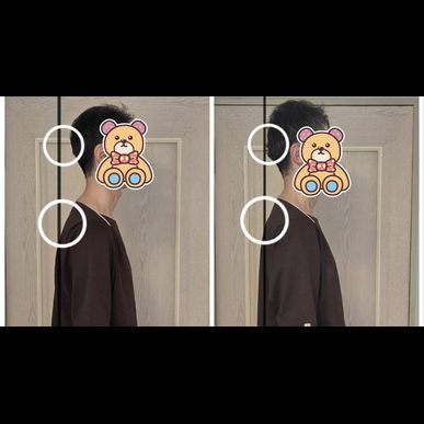 治療効果の検証📸姿勢のビフォーアフター　その4（指圧治療院WillRich）